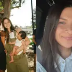 Influencer Allison Kuch Shows Botched Nose Job That Has Fallen to One Side