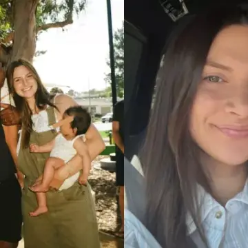 Influencer Allison Kuch Shows Botched Nose Job That Has Fallen to One Side