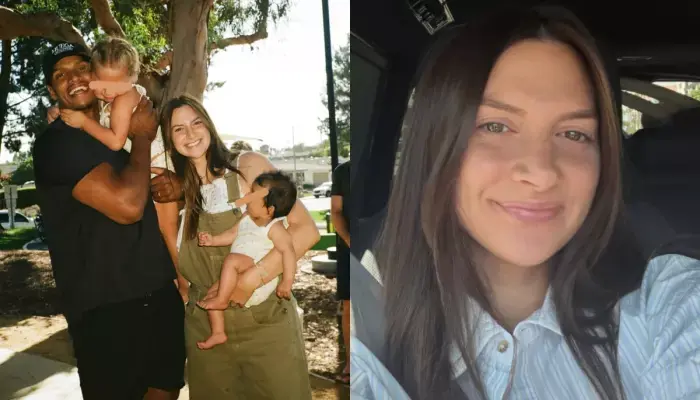 Influencer Allison Kuch Shows Botched Nose Job That Has Fallen to One Side