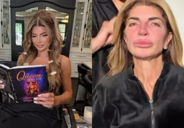 Teresa Giudice Appears Makeup-Free in New Video Following Thread Lift Procedure