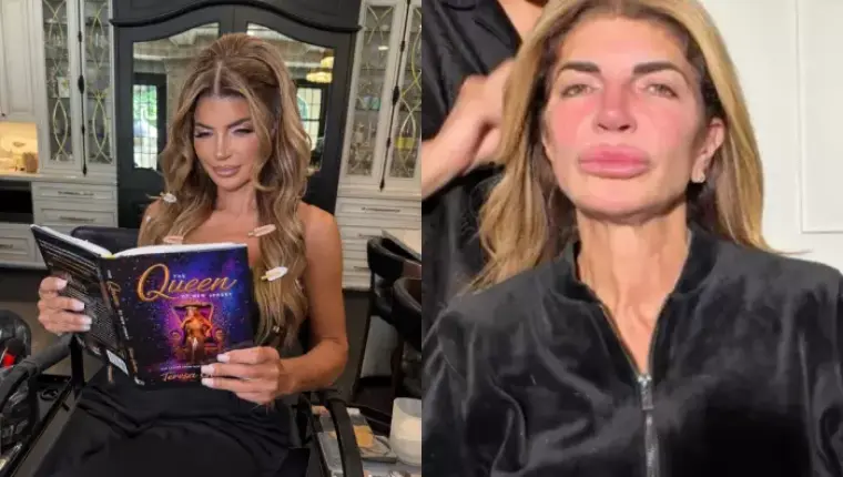 Teresa Giudice Appears Makeup-Free in New Video Following Thread Lift Procedure