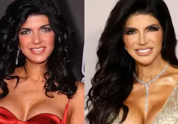 Teresa Giudice Opens Up About Her Breast Implants and Second Surgery