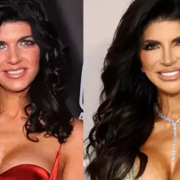 Teresa Giudice Opens Up About Her Breast Implants and Second Surgery