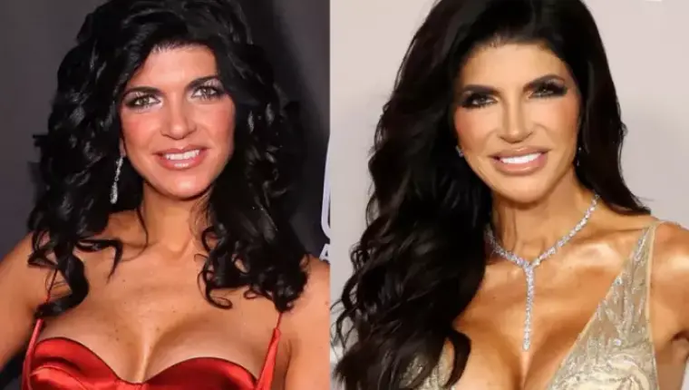 Teresa Giudice Opens Up About Her Breast Implants and Second Surgery