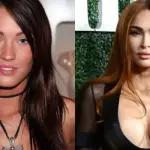 Megan Fox's Then-Vs-Now Photos Surface Amid Discussion on Cosmetic Surgery