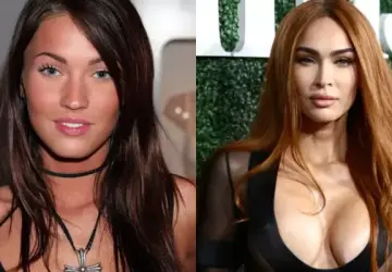 Megan Fox's Then-Vs-Now Photos Surface Amid Discussion on Cosmetic Surgery