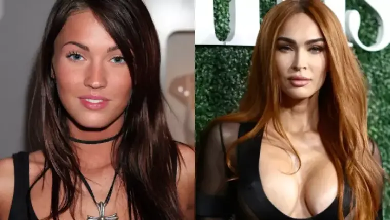 Megan Fox's Then-Vs-Now Photos Surface Amid Discussion on Cosmetic Surgery