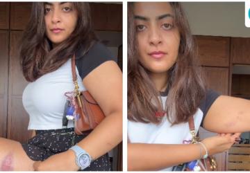 Aamir Khan's Niece Zayn Marie Shows Injury Marks After Detention in Mumbai