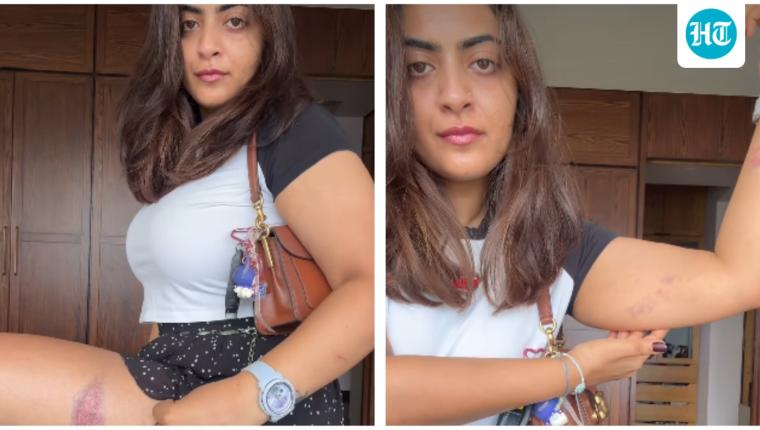 Aamir Khan's Niece Zayn Marie Shows Injury Marks After Detention in Mumbai