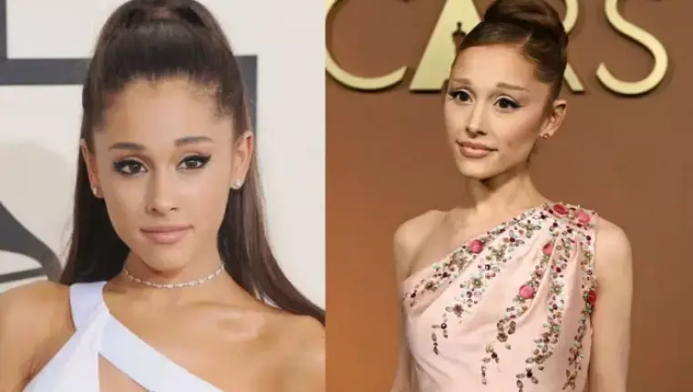 Ariana Grande Addresses Cosmetic Procedures and Past Surgeries