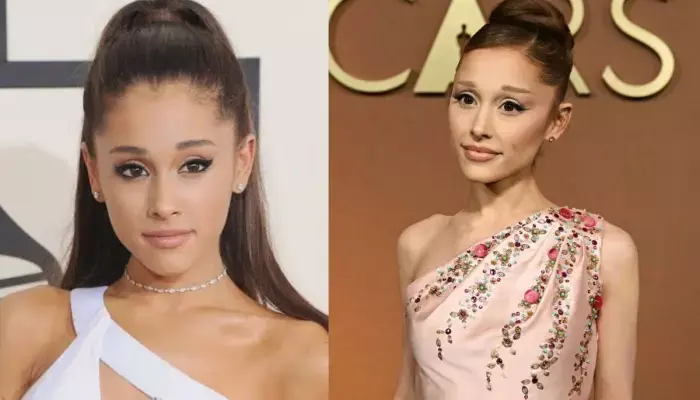 Ariana Grande Addresses Cosmetic Procedures and Past Surgeries
