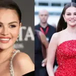 Selena Gomez Sparks Discussion Over Altered Veneers at Rare Impact Fund Benefit