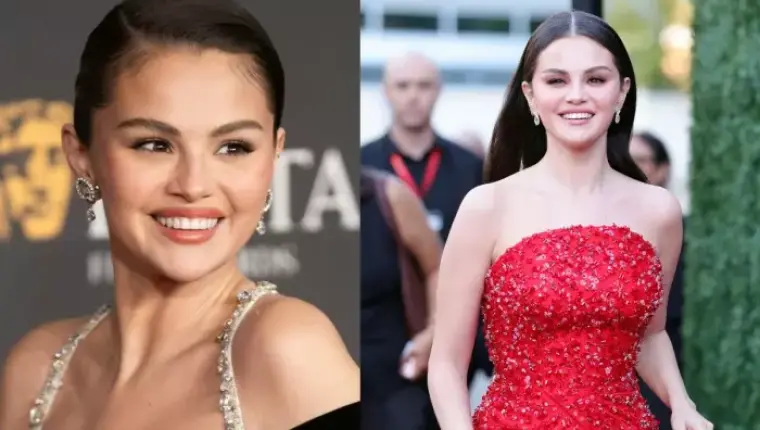Selena Gomez Sparks Discussion Over Altered Veneers at Rare Impact Fund Benefit