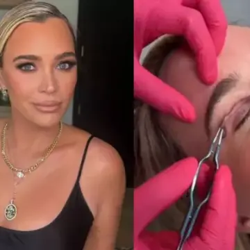 Teddi Mellencamp Defends Cosmetic Surgery Amid Stage 4 Cancer Diagnosis