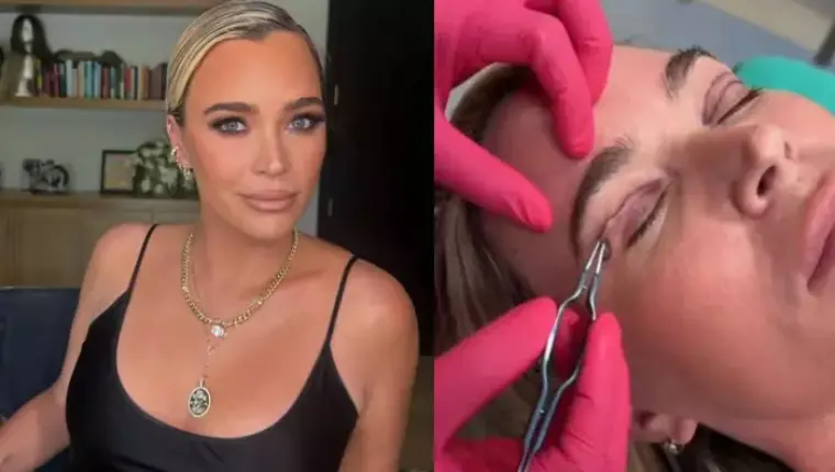 Teddi Mellencamp Defends Cosmetic Surgery Amid Stage 4 Cancer Diagnosis