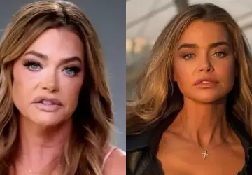 Denise Richards' Before-and-After Photos Resurface Following Remarks by Ex-Husband Aaron Phypers