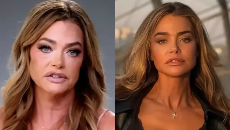 Denise Richards' Before-and-After Photos Resurface Following Remarks by Ex-Husband Aaron Phypers