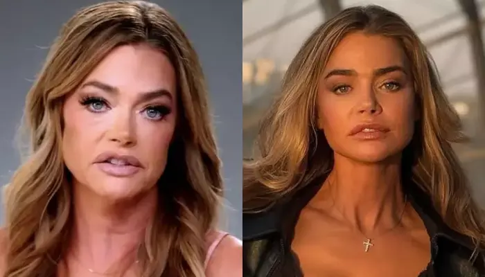 Denise Richards' Before-and-After Photos Resurface Following Remarks by Ex-Husband Aaron Phypers